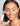 Dark Spots & Uneven Tone